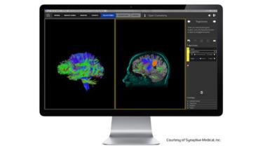 Synaptive Medical EDC Feature