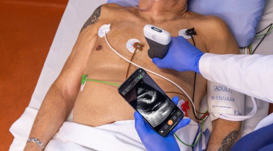 A nurse using a handheld ultrasound scanner on a man’s chest while observing the results on a phone, as he lays in a hospital bed.